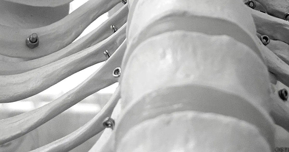 PEEK spinal cage machining context: a black and white close-up of an anatomical model showing ribs and vertebrae
